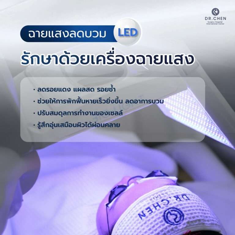 บริการฉายแสงลดบวมหลังศัลยกรรม