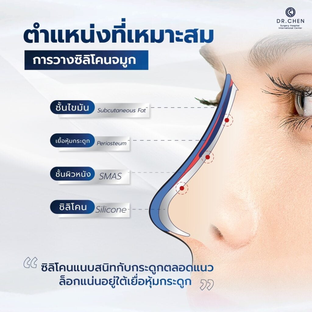 ตำแหน่งที่เหมาะสมการวางซิลิโคนจมูก