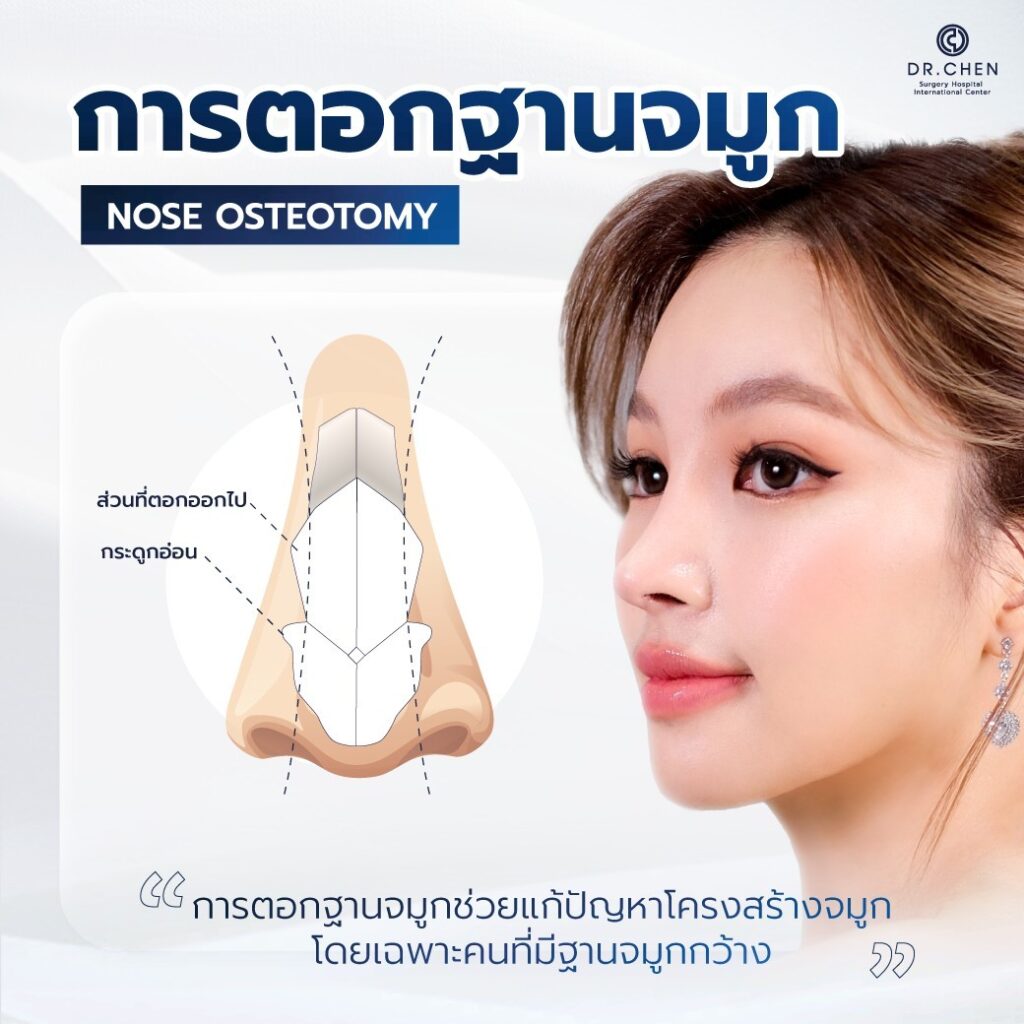 การตอกฐานจมูกเหมาะกับใคร?