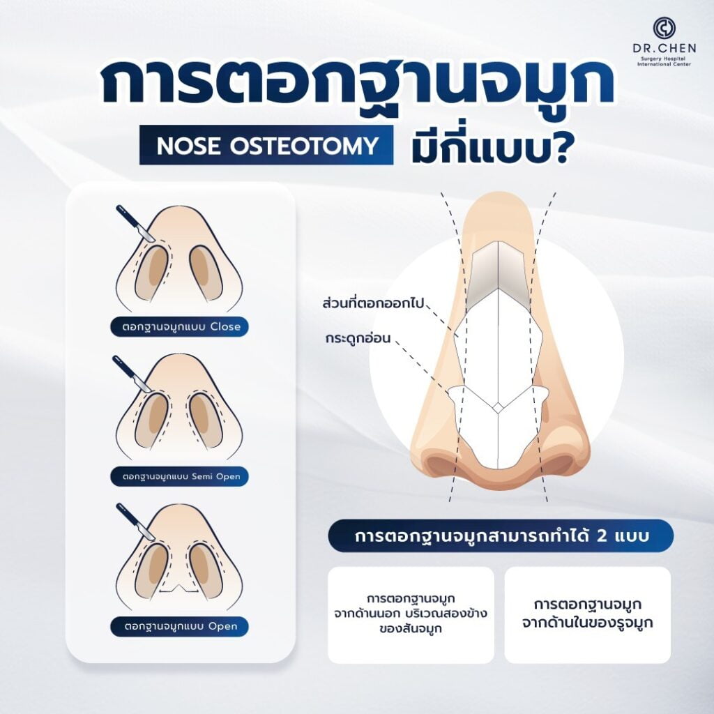 การตอกฐานมีกี่ชนิด? ทำได้กี่แบบ