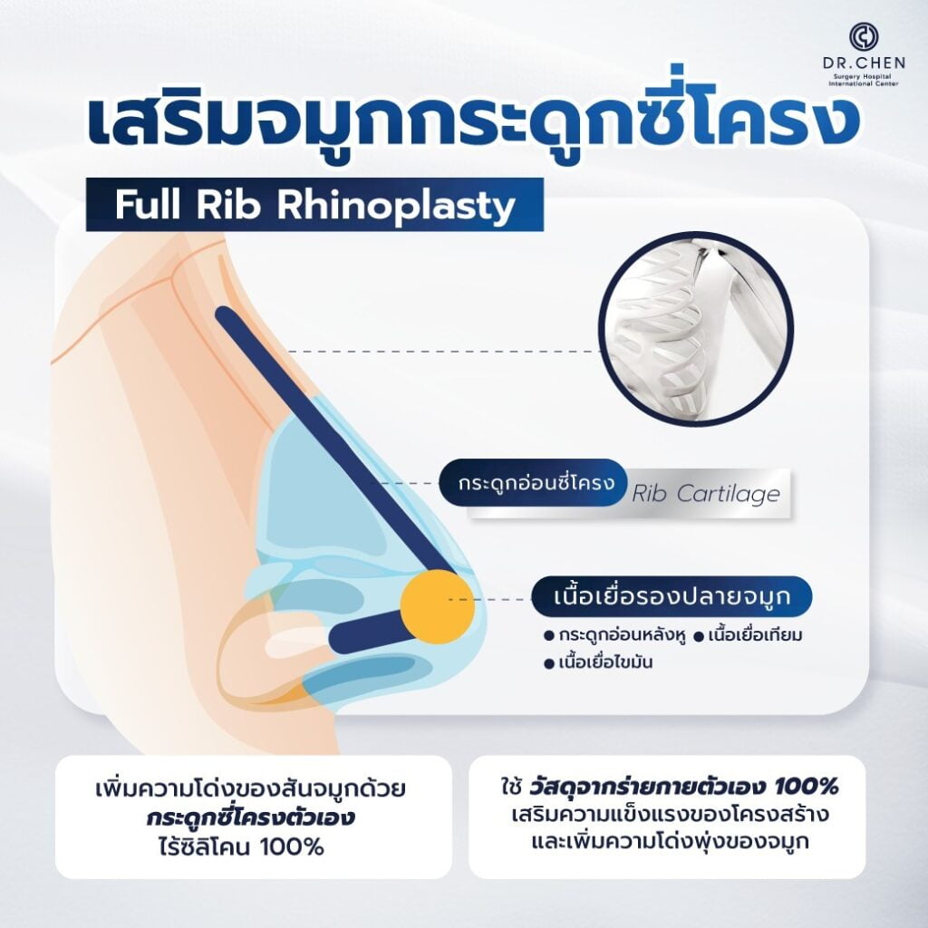 เสริมจมูกด้วยกระดูกอ่อนซี่โครง ไร้ซิลิโคน ( Rib Rhinoplasty )