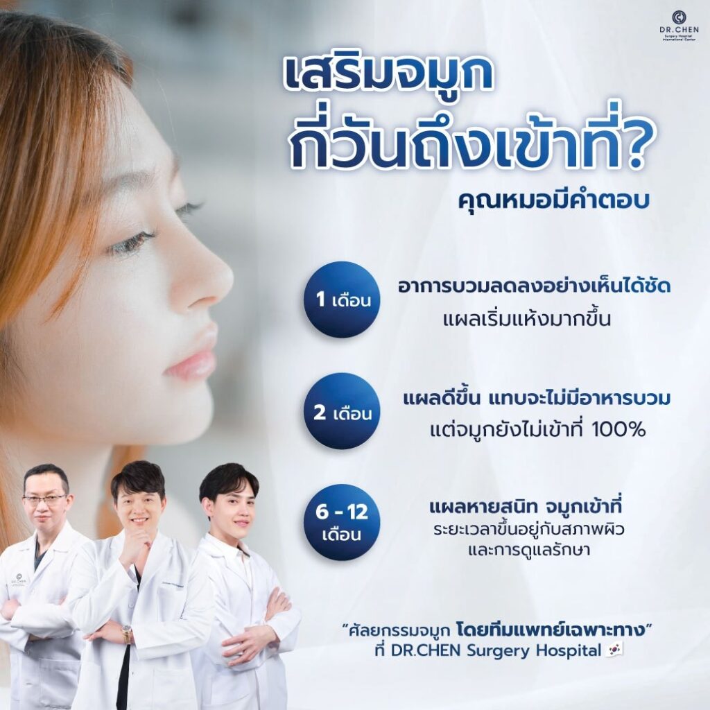 เสริมจมูกจะเข้าที่ใช้ระยะเวลาเท่าไหร่?