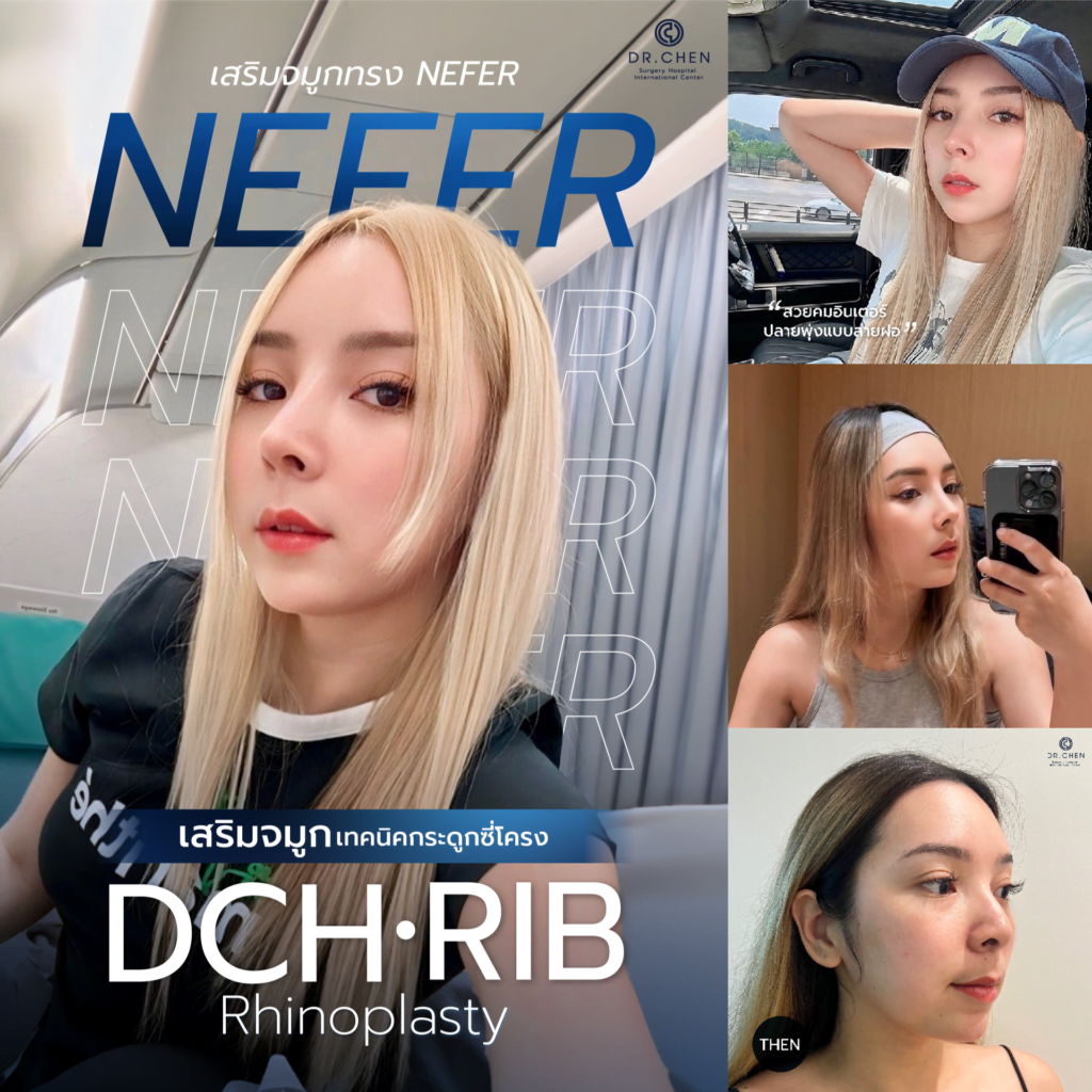 เสริมจมูกทรง neffr