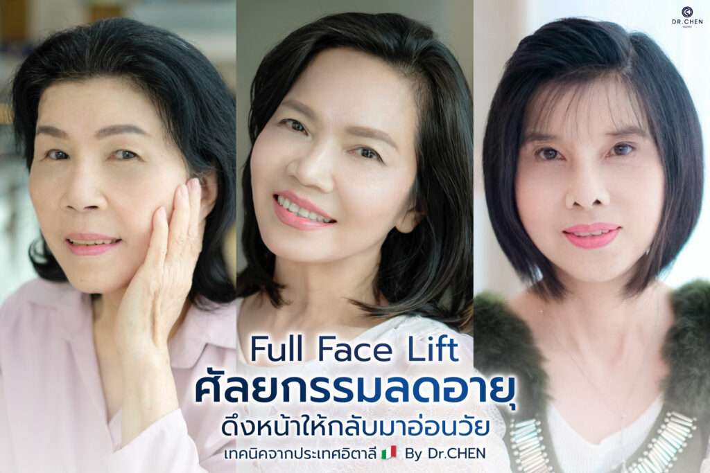 รีวิวศัลยกรรมดึงหน้า