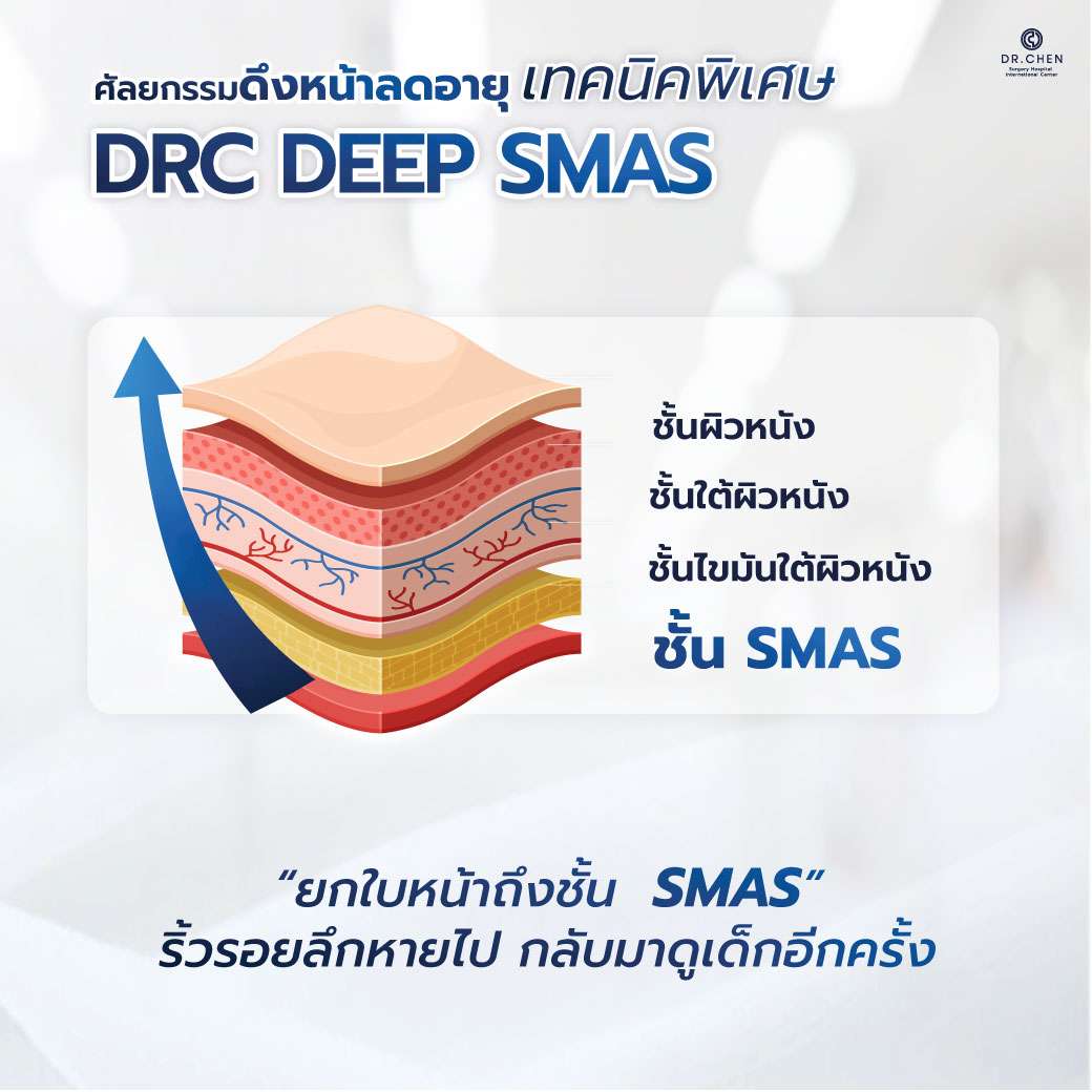 ยกใบหน้าถึงชั้น SMAS