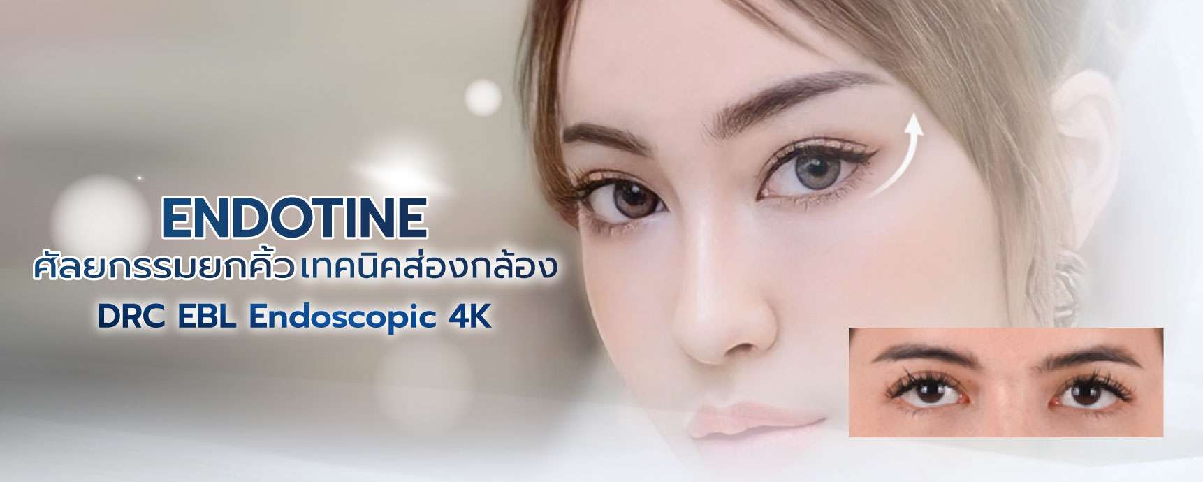 ส่องกล้อง