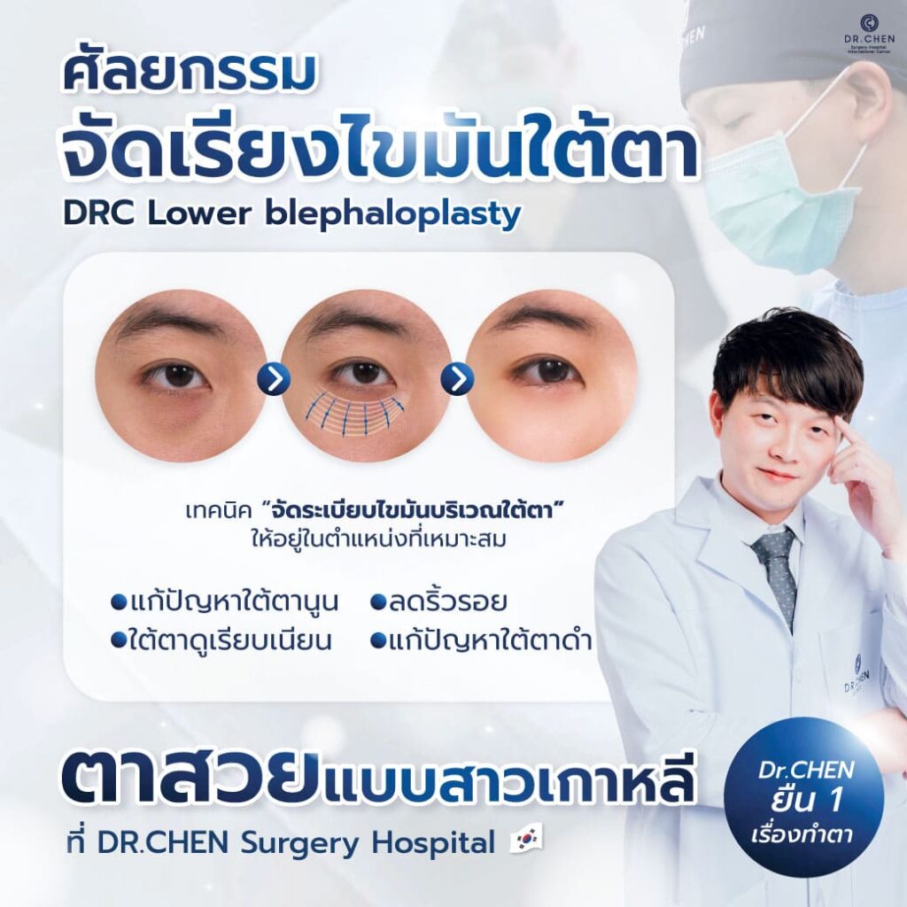 ศัลยกรรมใต้ตาเทคนิคพิเศษ DRC
