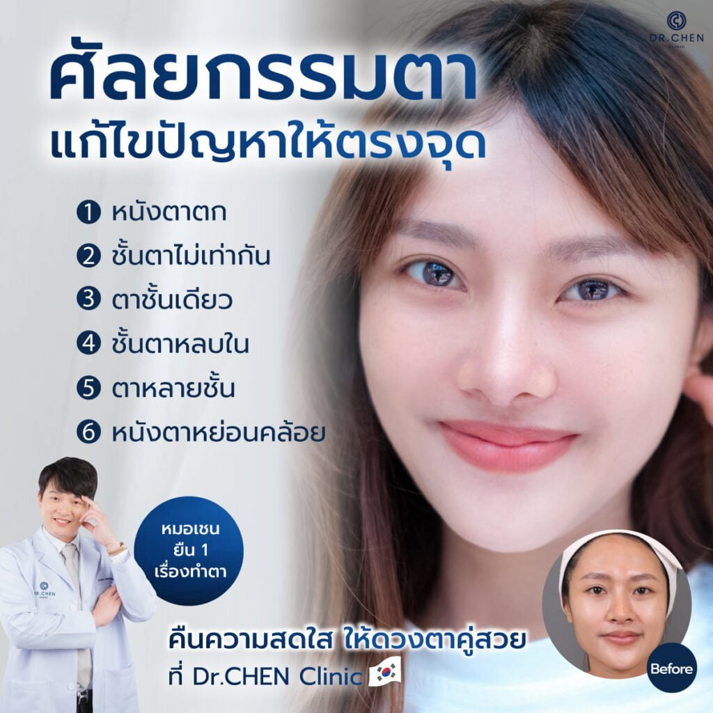 ศัลยกรรมตาสองชั้นเหมาะกับใคร