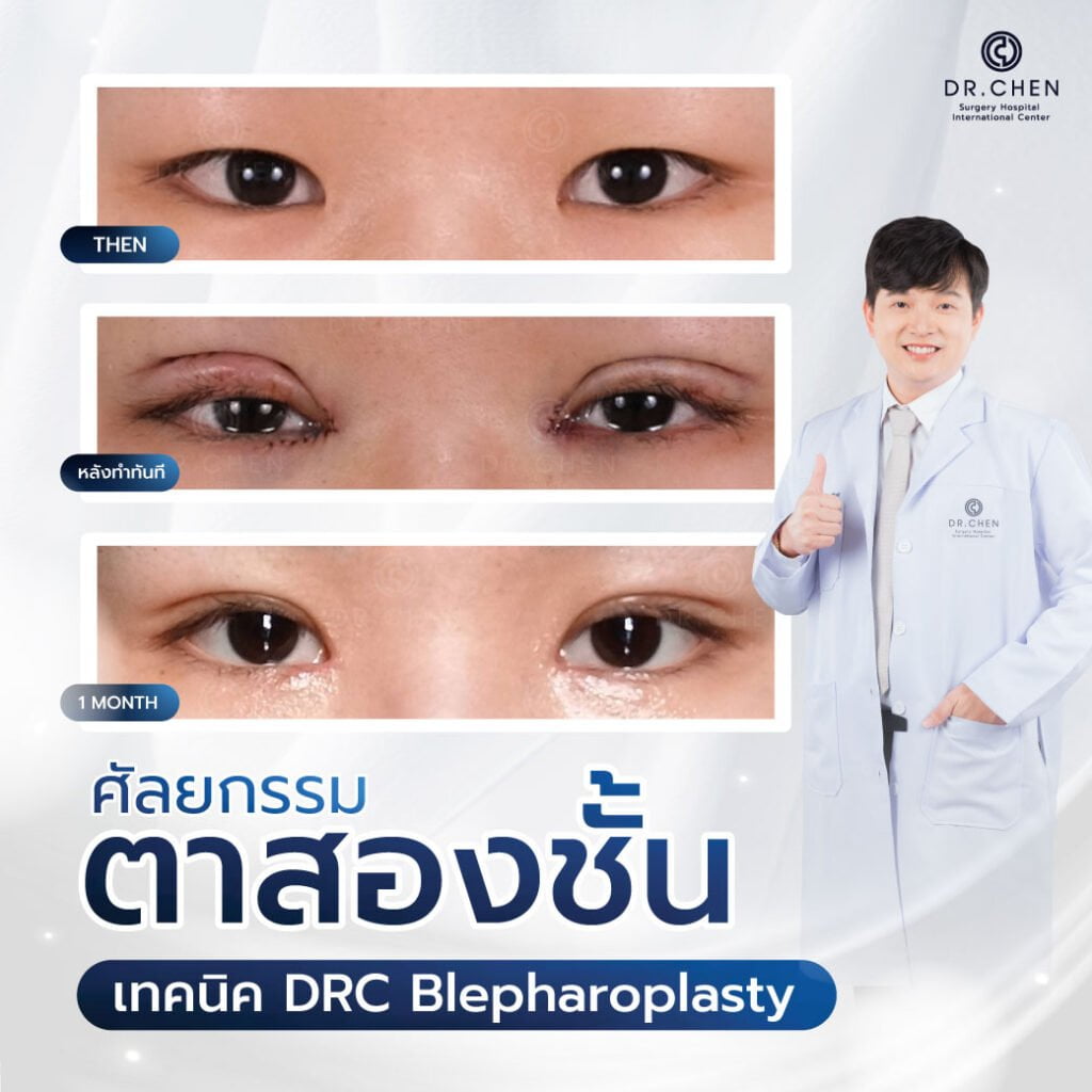 drc blepharoplasty