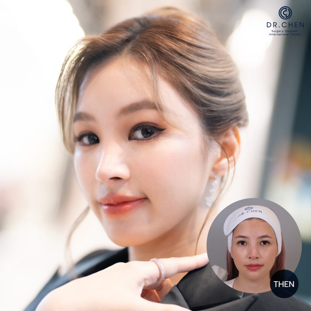 ศัลยกรรมดึงหน้าผู้หญิง