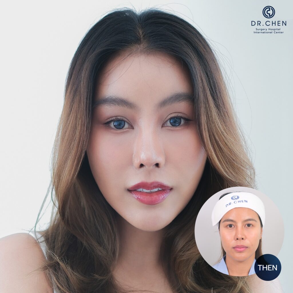 ศัลยกรรมดึงหน้าผู้หญิง