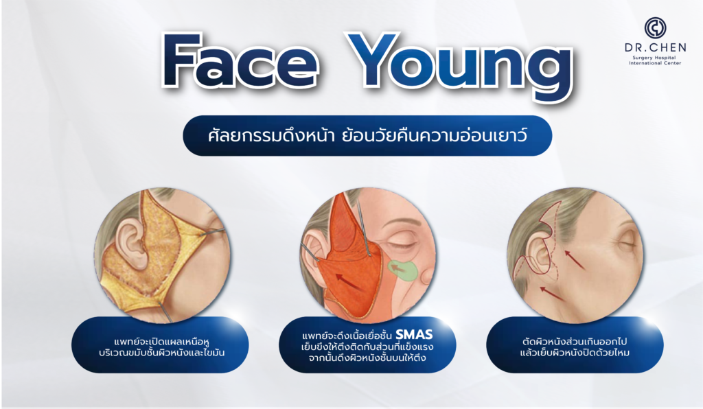 Face Young ดึงหน้าย้อนวัย