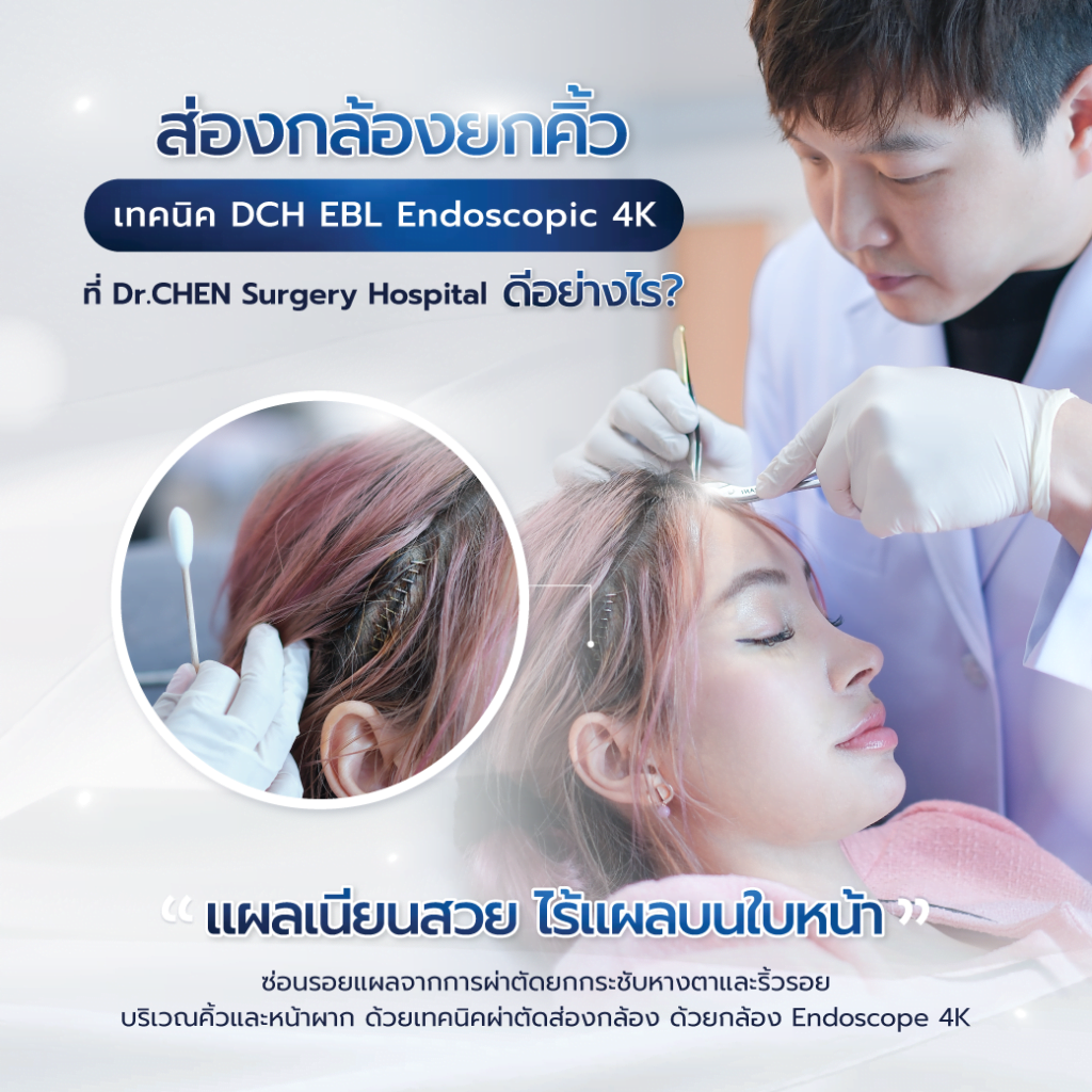 ศัลยกรรมยกคิ้วเทคนิคซ่อนแผล